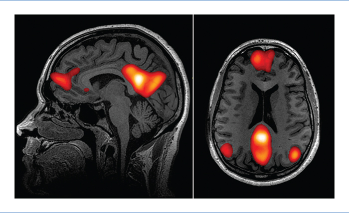 Comment utiliser les neurosciences et la neuroplasticité pour manifester vos désirs
